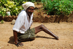 Beinamputierter Mann